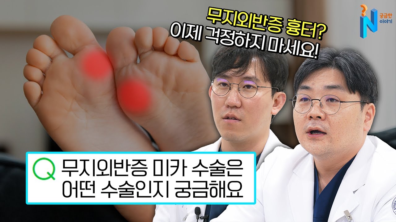 [궁금한이야기N] 무지외반증 검색해본 사람은 들어본 그 수술에 대한 모든 것!