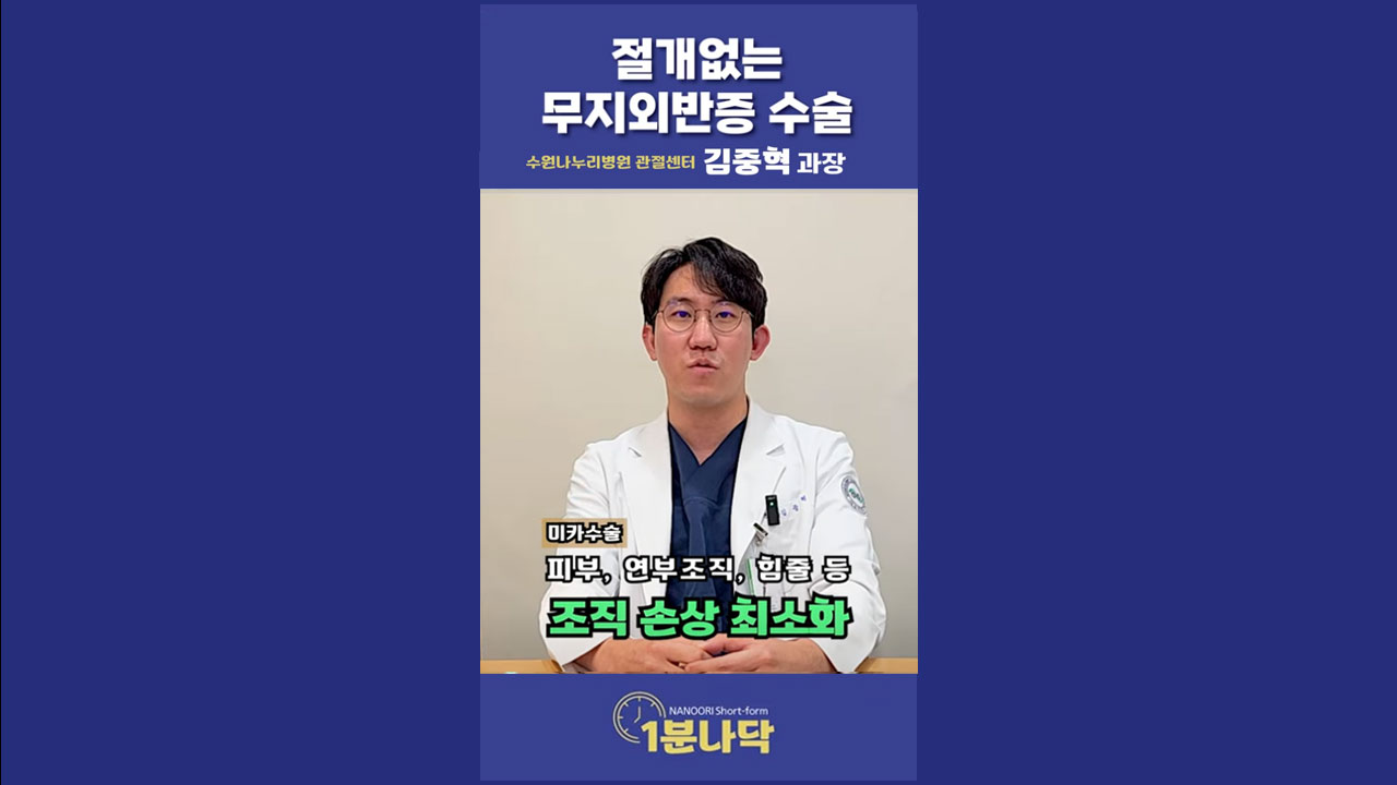 [1분나닥] 절개없는 무지외반증 수술! feat. 미카(MICA)수술